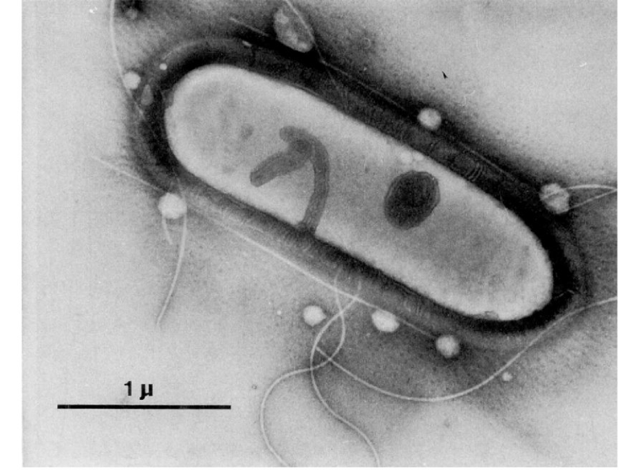 Clostridium ljungdahlii 